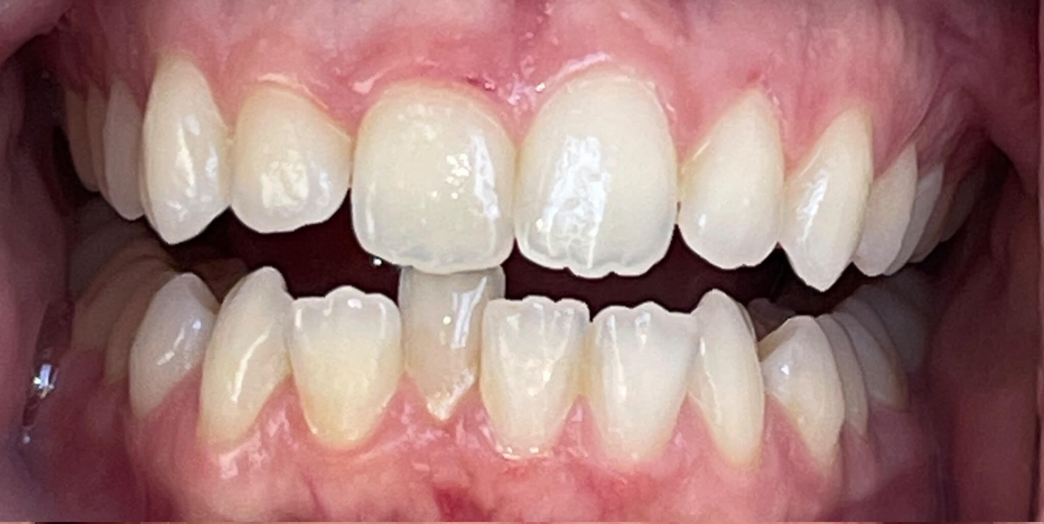 Before image alt