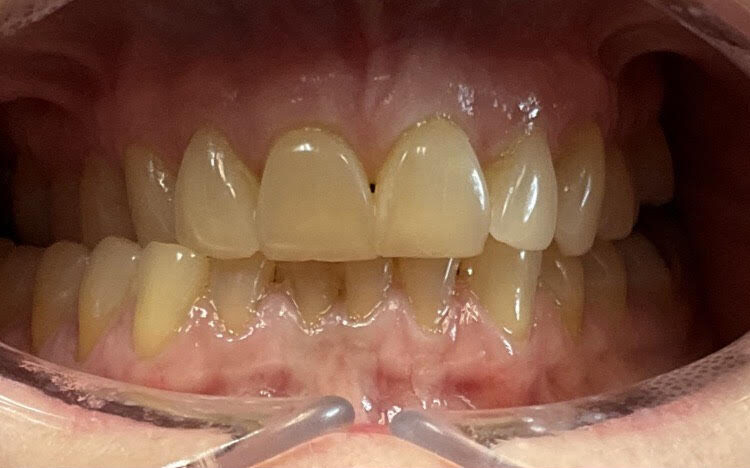 Before image alt